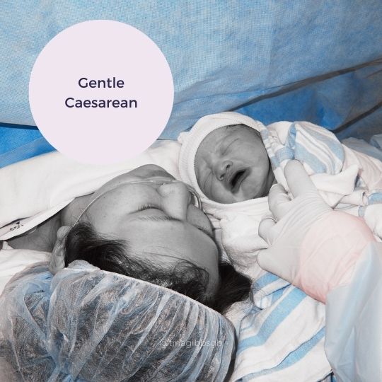 What is a gentle Caesarean&nbsp;Birth?